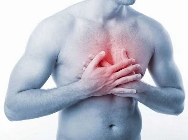 krūtinės ląstos osteochondrozės simptomai