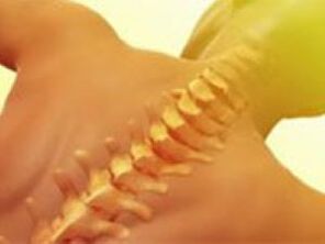 Osteochondrozė - stuburo liga