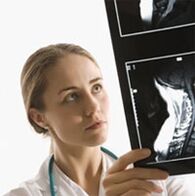 Osteochondrozės diagnozė nurodoma naudojant X -LAY tyrimą